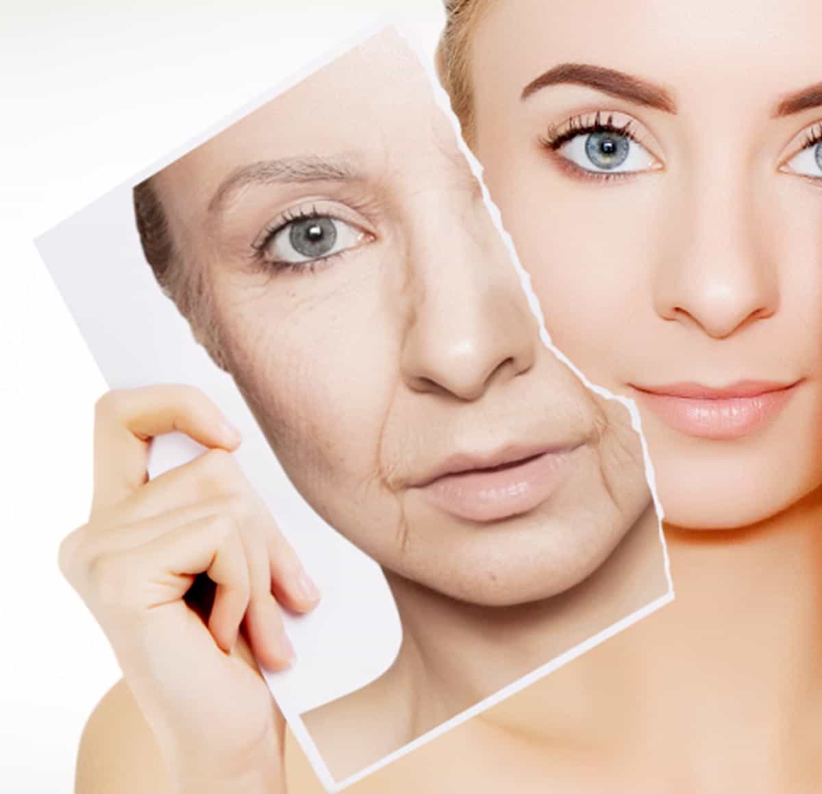 best fine line wrinkle treatment