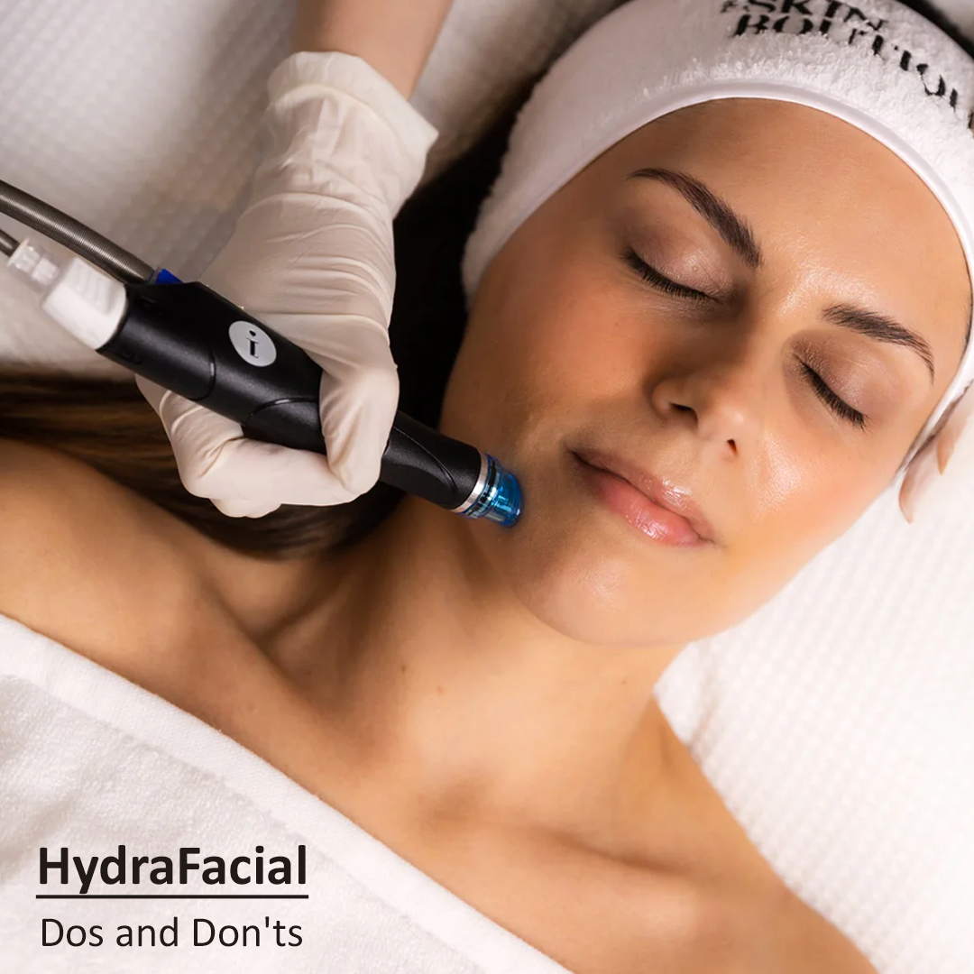 The Dos and Don’ts of HydraFacial: When to Avoid the Treatment